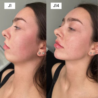 Elystia Face Sculpting Band