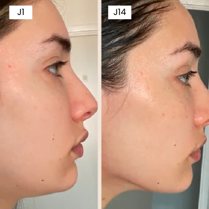 Elystia Face Sculpting Band