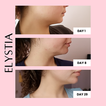 Elystia Face Sculpting Band