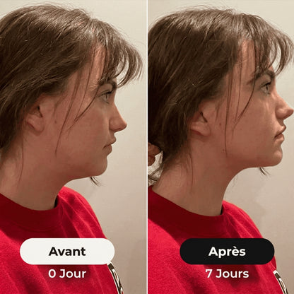 La Brosse Lymphatique